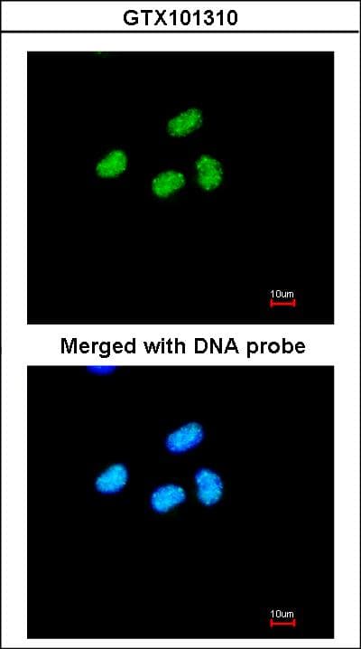 ATRX Antibody (aa2161-2443)