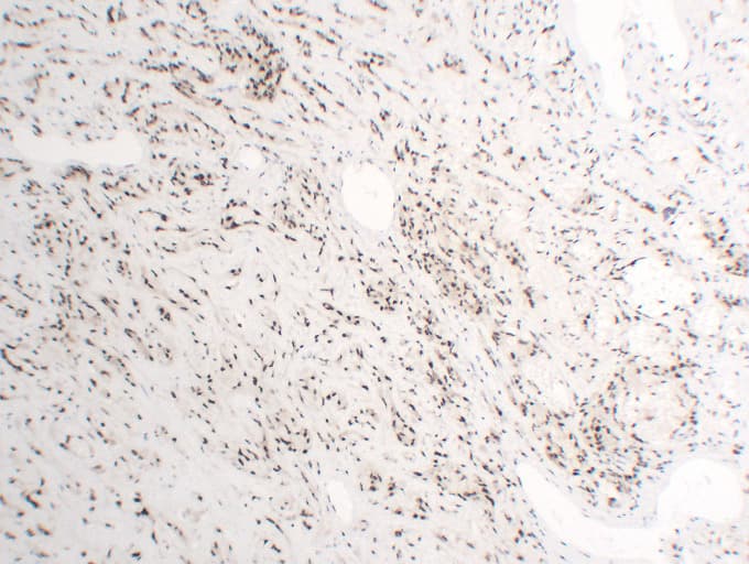 Monoclonal Mouse anti-Human FLI1 Antibody (clone ABT-FLI1, IHC, WB)