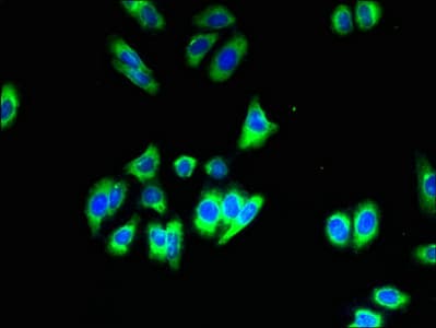 SLC35B1 / UGTREL1 Antibody
