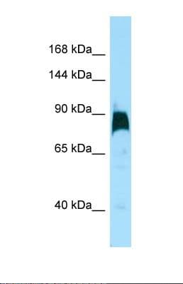 KIF7 Antibody (aa1266-1315)