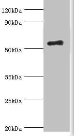 IKZF3 / AIOLOS Antibody (aa280-450)