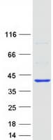 Human ARPC1B / p41-ARC / ARP2 Protein (Recombinant Myc-DDK (Flag))