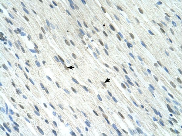 SERTAD1 / TRIP-Br1 / SEI-1 Antibody (N-Terminus)