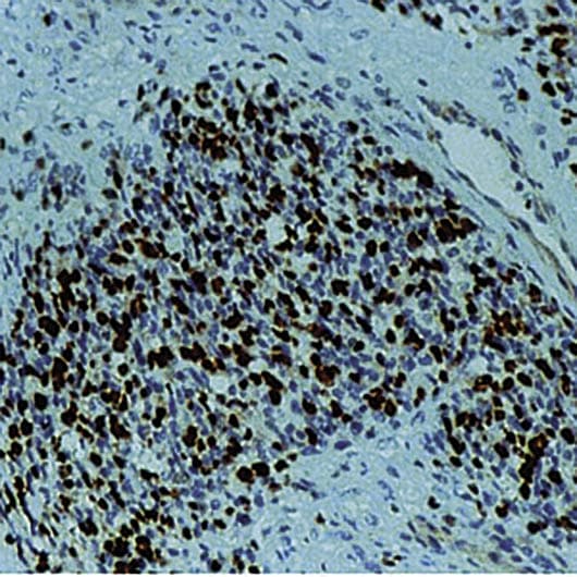 MYOG / Myogenin Antibody (clone F5D)