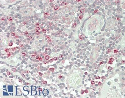 IHC-plus™ Polyclonal Rabbit anti-Human PLD4 / Phospholipase D4 Antibody (C-Terminus, IHC, WB)