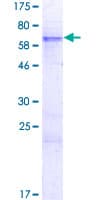 Human ZFP42 / REX-1 Protein (Recombinant GST)