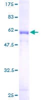 Human FGL1 / Hepassocin Protein (Recombinant GST)