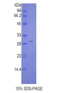 Mouse CTSC / Cathepsin C / JP Protein (Recombinant His)
