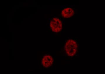 ATXN1 / SCA1 Antibody