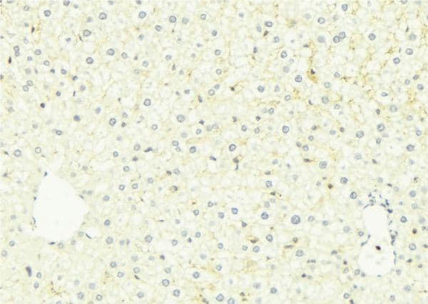 Polyclonal Rabbit anti-Human FUT3 Antibody (IHC, IF, WB)