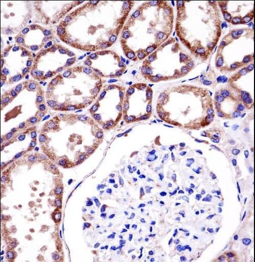 Polyclonal Rabbit anti-Human RC3H1 / ROQUIN Antibody (aa1015-1043, IHC, WB)