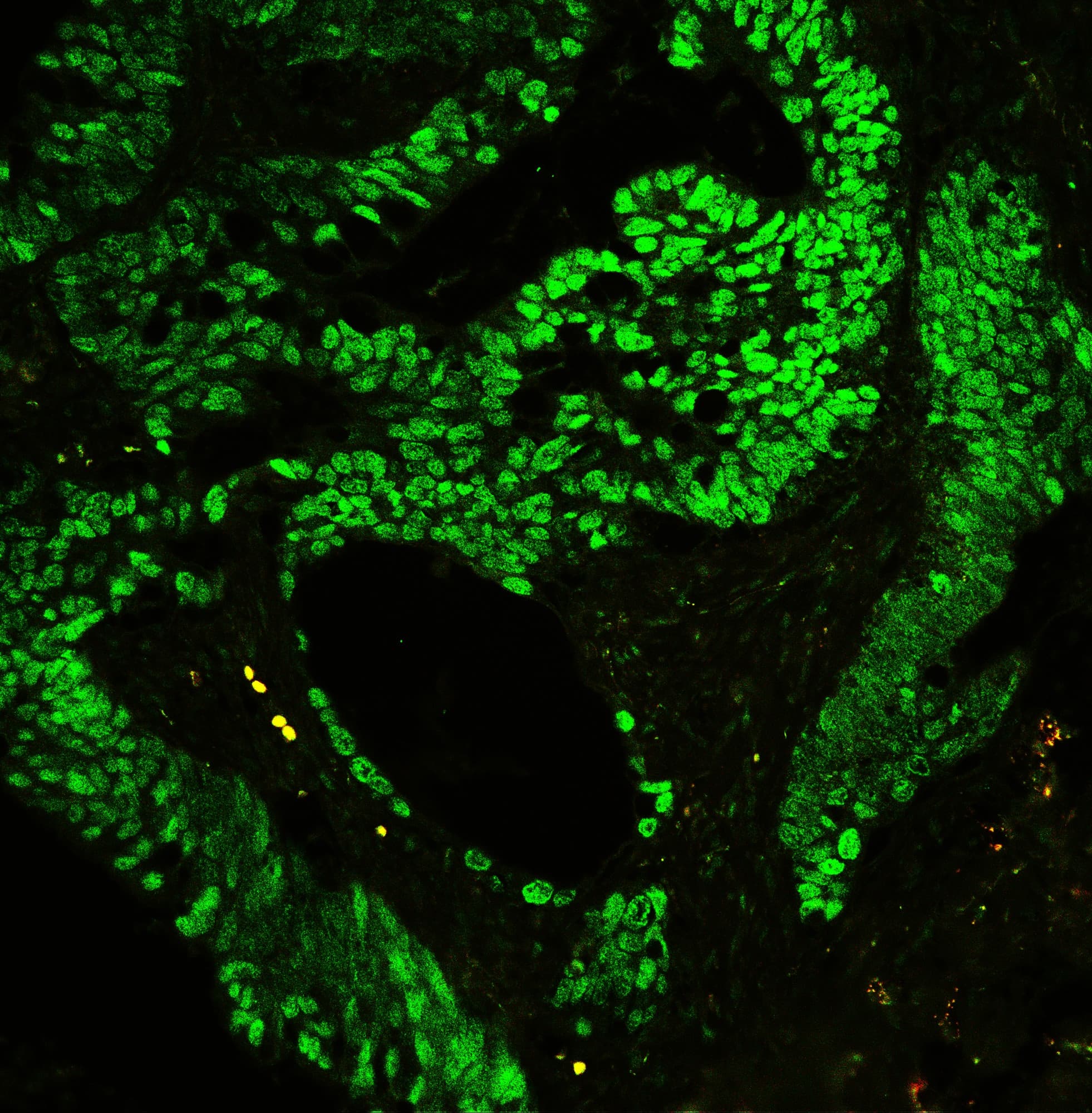 CTBP2 Antibody (aa321-445)