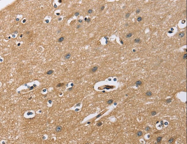 CD135 / FLT3 Antibody