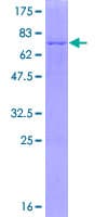 Human SCAD / ACADS Protein (Recombinant GST)