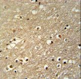 TFAP4 / AP-4 Antibody (aa306-334)