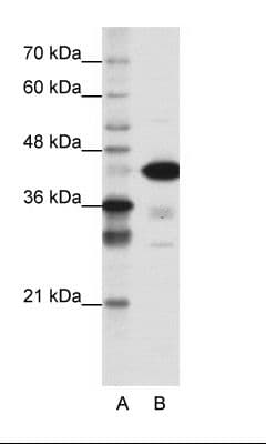 TDP-43 / TARDBP Antibody (N-Terminus)