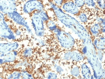 Monoclonal Mouse anti-Human SPTA1 / Alpha Spectrin Antibody (clone SPTA1/1810, Azide-free,BSA-free, IHC)