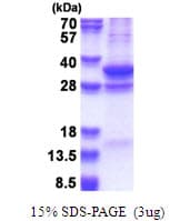Human COPS7A Protein (Recombinant His)