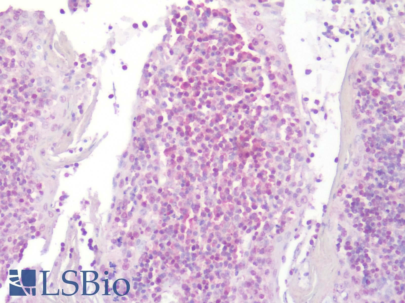 PathPlus™ Leukotriene B4 Receptor / BLT1 Antibody (Cytoplasmic Domain)