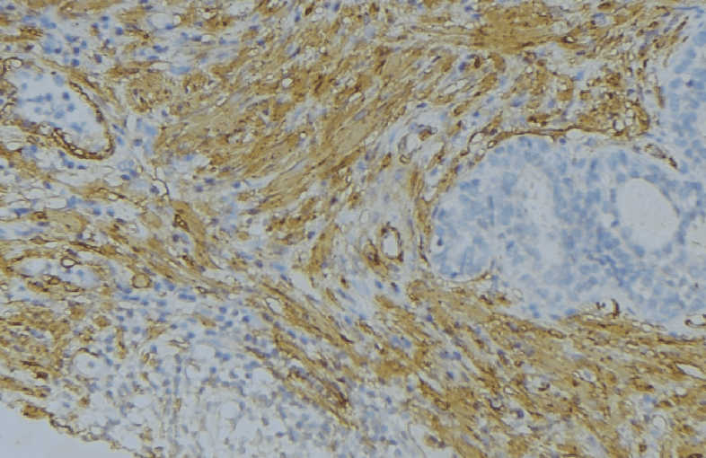 FGF18 Antibody