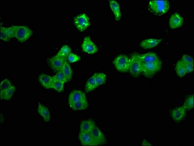 Polyclonal Rabbit anti-Human TNFRSF10B / Killer / DR5 Antibody (IF)