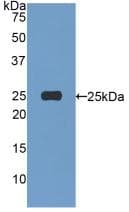 AFM / Afamin Antibody (aa22-210, APC)