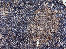 EPM2AIP1 Antibody (clone OTI1G9)