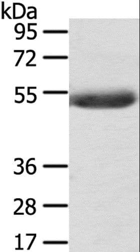 AGPAT6 Antibody