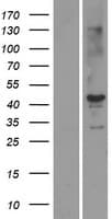 STK19 Protein (Over-Expression Lysate Myc-DDK (Flag))