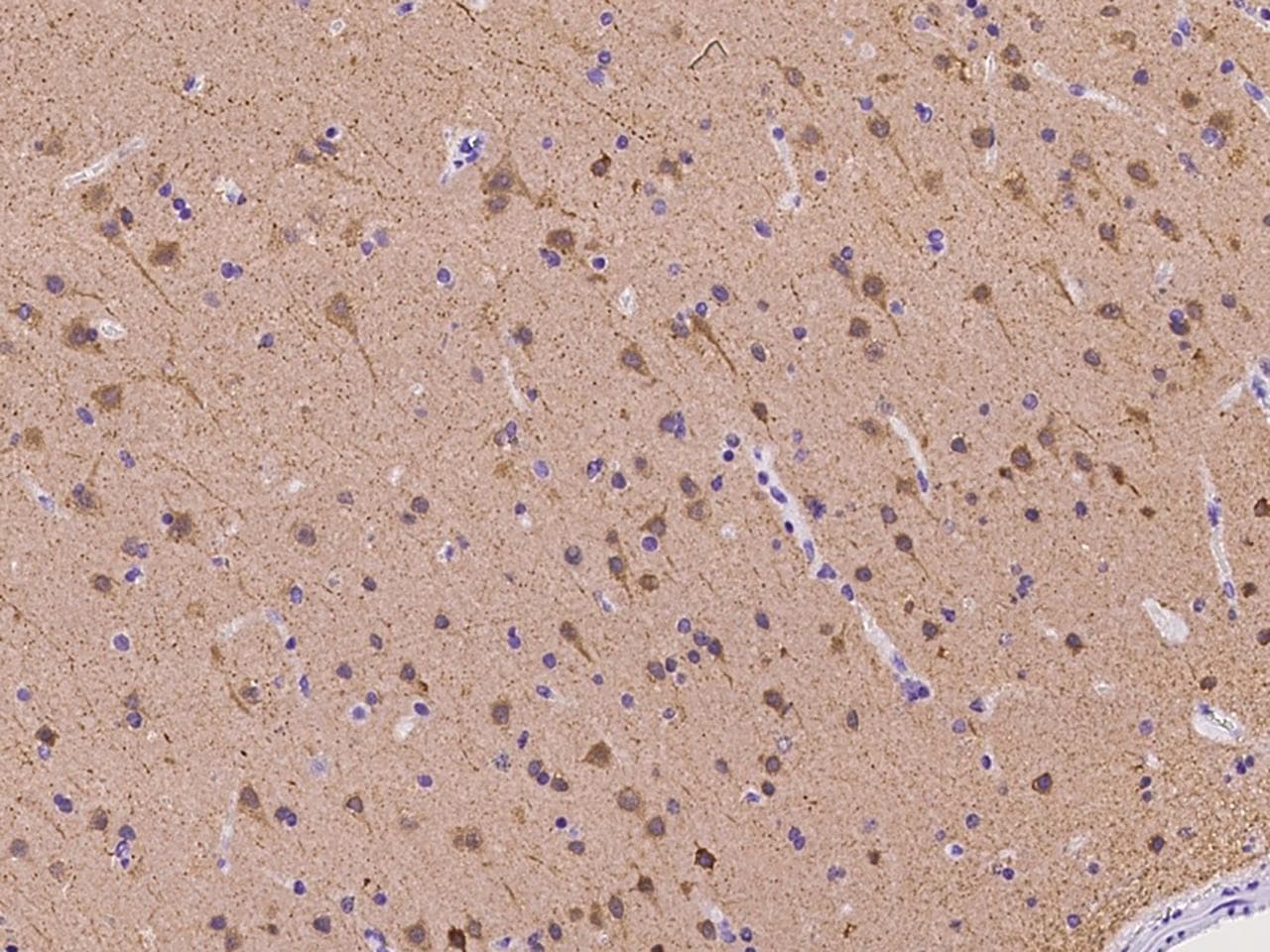 EFCBP2 / NECAB2 Antibody