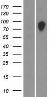 OS9 Protein (Over-Expression Lysate Myc-DDK (Flag))