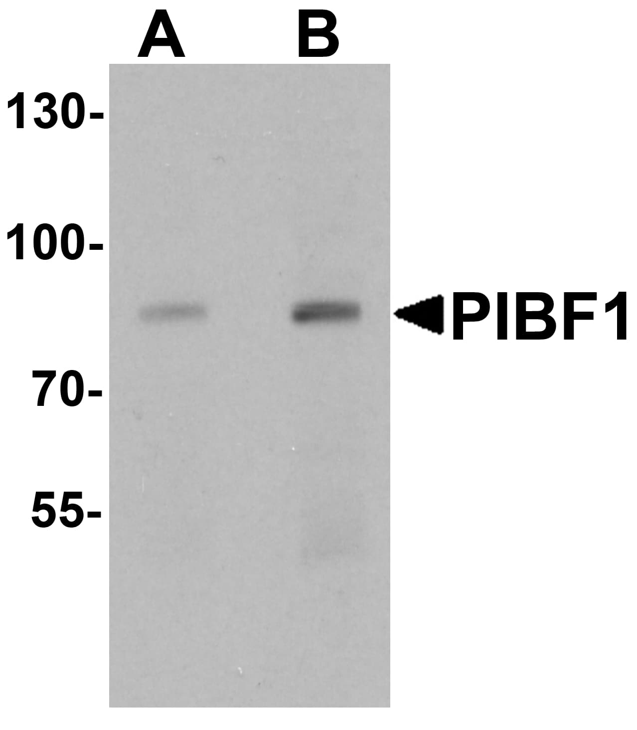 IHC-plus™ PIBF1 / PIBF Antibody