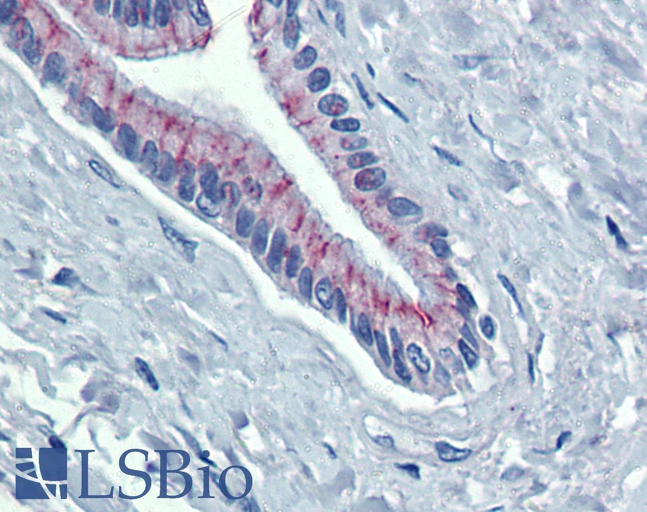 Polyclonal Rabbit anti-Human DSG2 / Desmoglein 2 Antibody (aa72-121, IHC, WB)