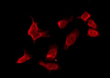 OR10T2 Antibody
