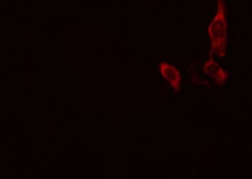 Polyclonal Rabbit anti-Human PRKD1 / PKC Mu Antibody (IF, WB)