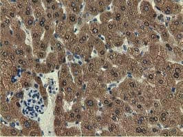 EPHX2 / Epoxide Hydrolase 2 Antibody (clone OTI1A6, Carrier-free)