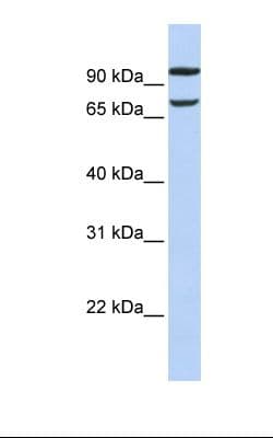 PIEZO2 / FAM38B Antibody (aa2570-2619)