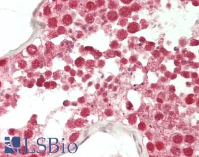 IHC-plus™ RPUSD3 Antibody
