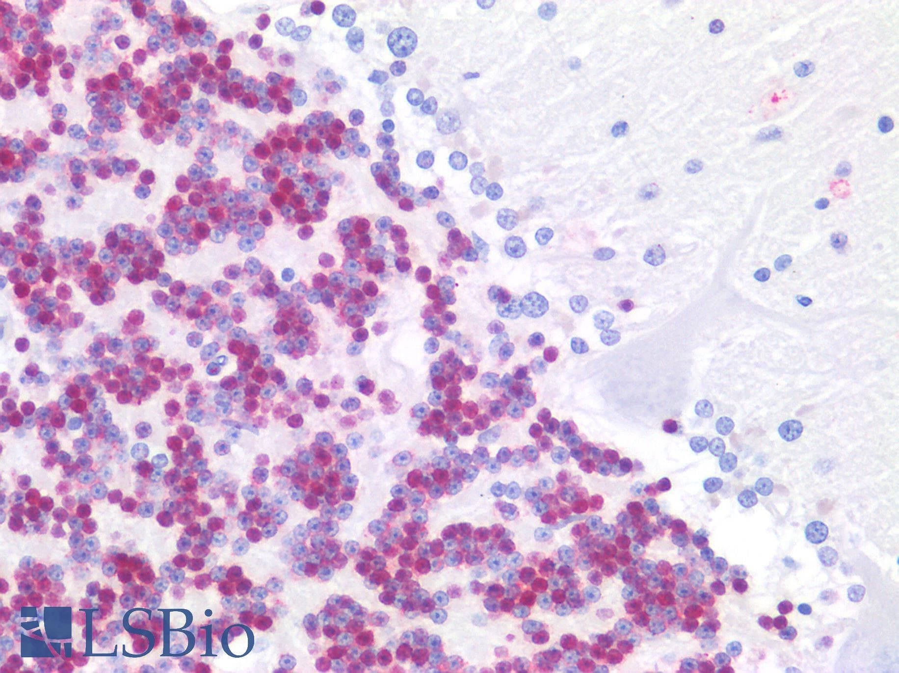 PathPlus™ Polyclonal Rabbit anti-Human RBFOX3 / NEUN Antibody (IHC, IF, WB)