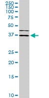 ISLET-1 / ISL1 Antibody (clone 1A3)