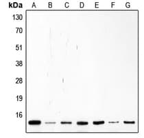 Polyclonal Rabbit anti-Human p14ARF / CDKN2A Antibody (Internal, IHC, IF, WB)