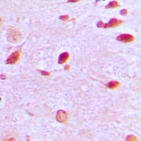 RAP1GAP Antibody (C-Terminus)
