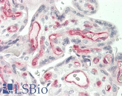 IHC-plus™ GFI1B Antibody (Internal)