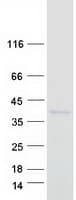 Human TFPI / LACI Protein (Recombinant Myc-DDK (Flag))