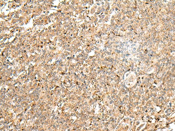 Polyclonal Rabbit anti-Human FLOT2 / Flotillin 2 Antibody (IHC, WB)
