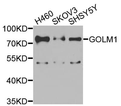 GOLM1 / GP73 / GOLPH2 Antibody