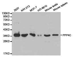 Polyclonal Rabbit anti-Human PPP4C Antibody (IHC, WB)