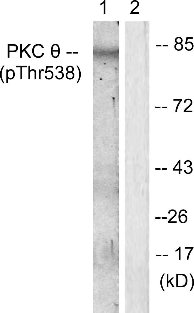 PRKCQ / PKC-Theta Antibody (phospho-Thr538)