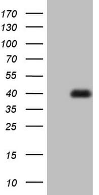 MEOX1 Antibody (clone OTI1B3)