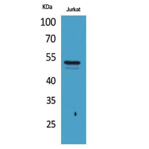 Polyclonal Rabbit anti-Human Alpha Tubulin Antibody (acetylation site of K40., WB)